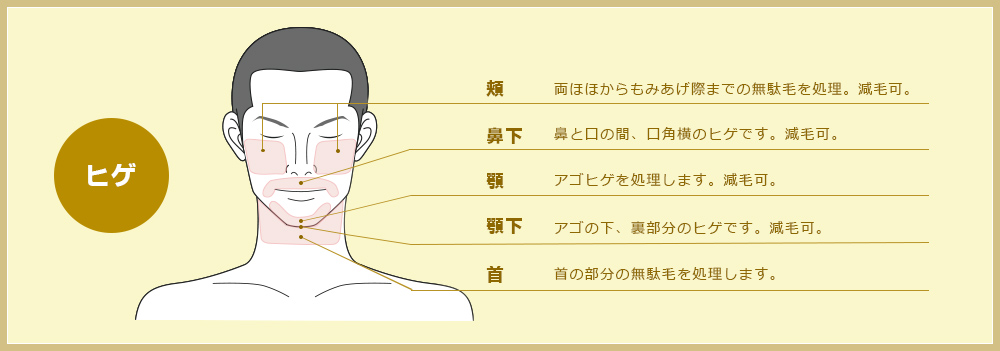 ひげ脱毛の脱毛部位