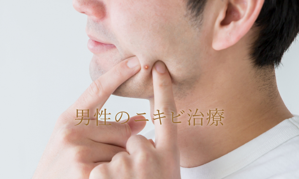 男性（メンズ）のニキビ・ニキビ跡治療について解説