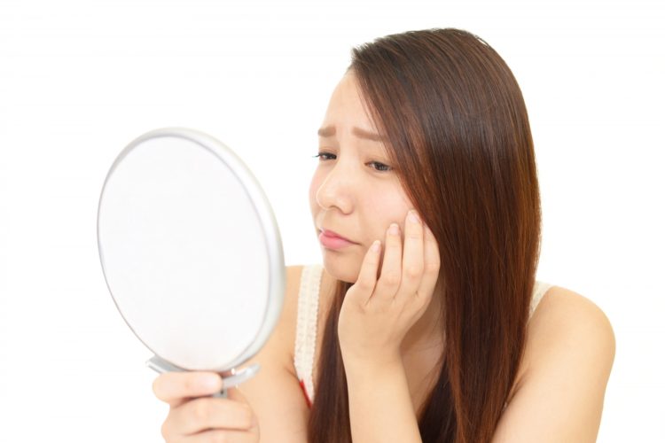 コラーゲン不足でしわが気になる女性