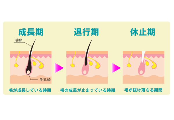 毛根断面歴史