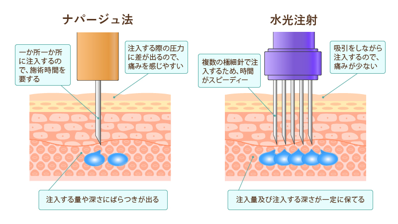 水光注射に使用する機械の本体（ダーマシャインプロ）