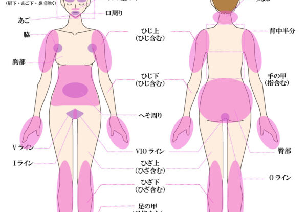 脱毛部位画像