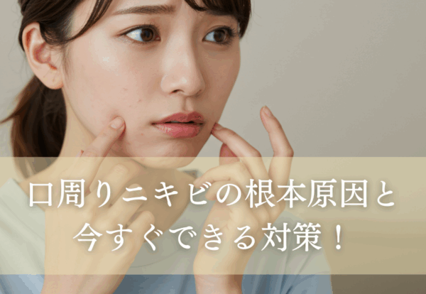 口周りニキビの根本原因と今すぐできる対策！