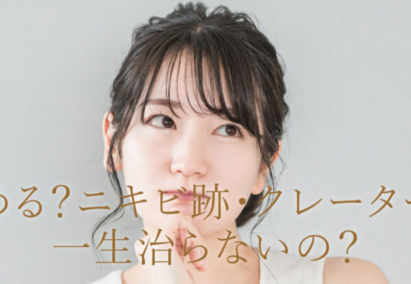 諦める？ニキビ跡クレーターは一生治らない？