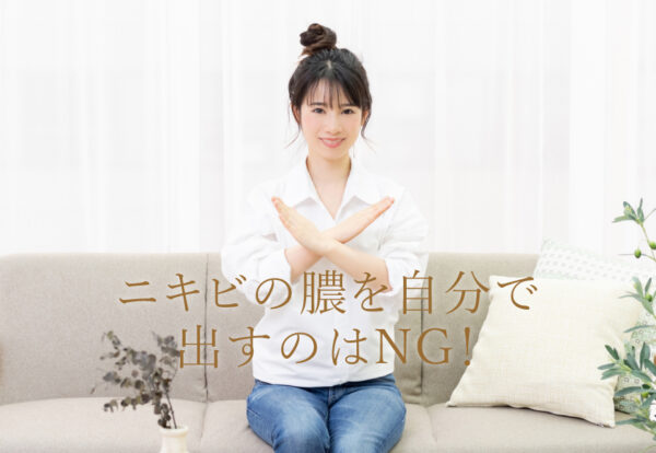 ニキビの膿を自分で出すのはNG！