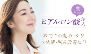 額（おでこ）ヒアルロン酸注入