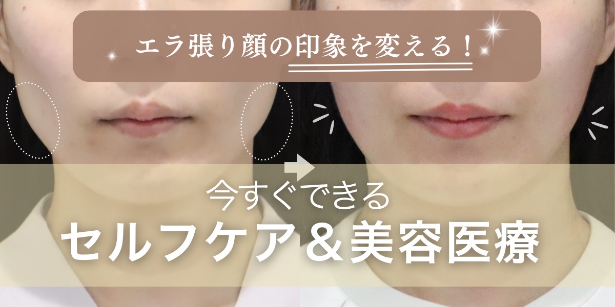 エラ張り顔の印象を変える！今すぐできるセルフケア＆美容医療