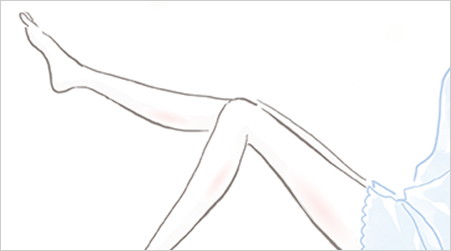 ほっそりとしたふくらはぎになりたい女性