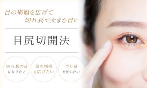 目尻切開法