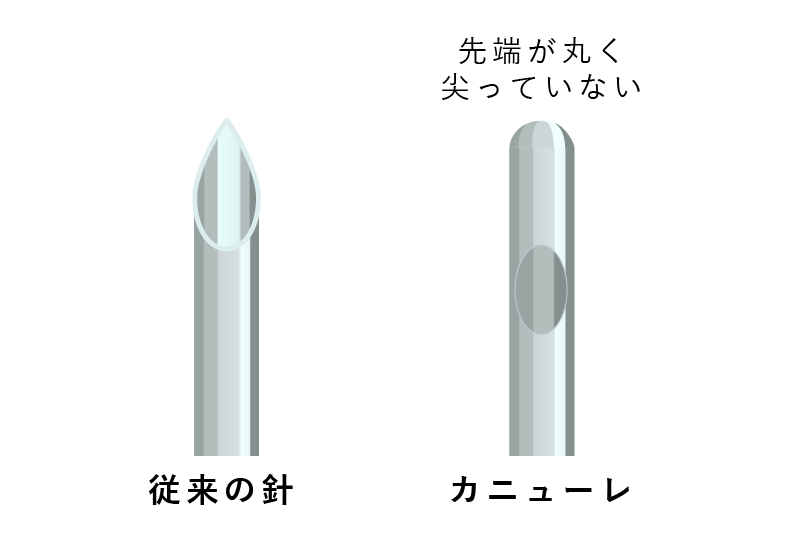 従来の針とカニューレの比較図
