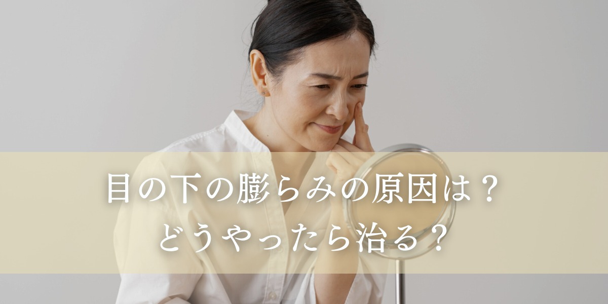 目の下の膨らみの原因は?どうやったら治る?
