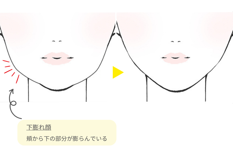 下膨れ顔の特徴