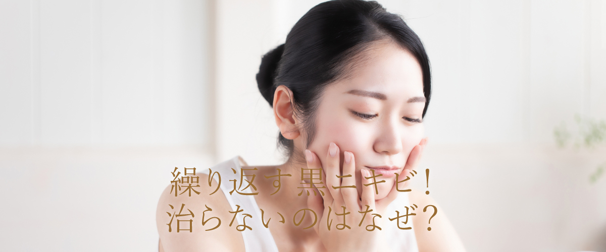 繰り返す黒ニキビ!治らないのはなぜ?
