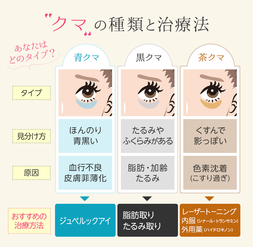 目の下のクマの種類と治療法