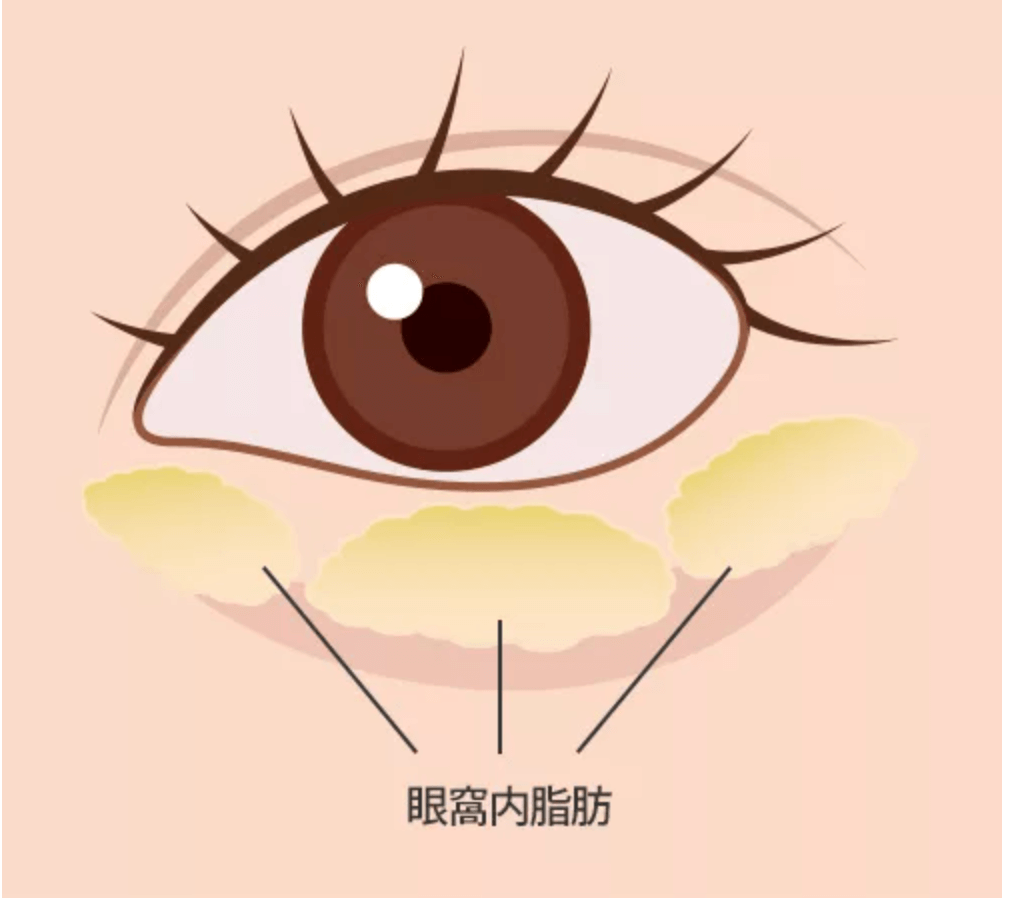 眼窩内脂肪の説明図