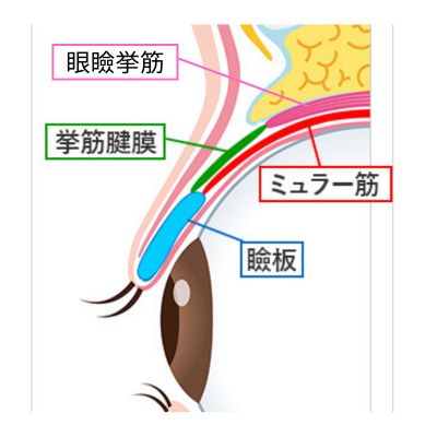眼瞼挙筋、挙筋腱膜、ミュラー筋の図解