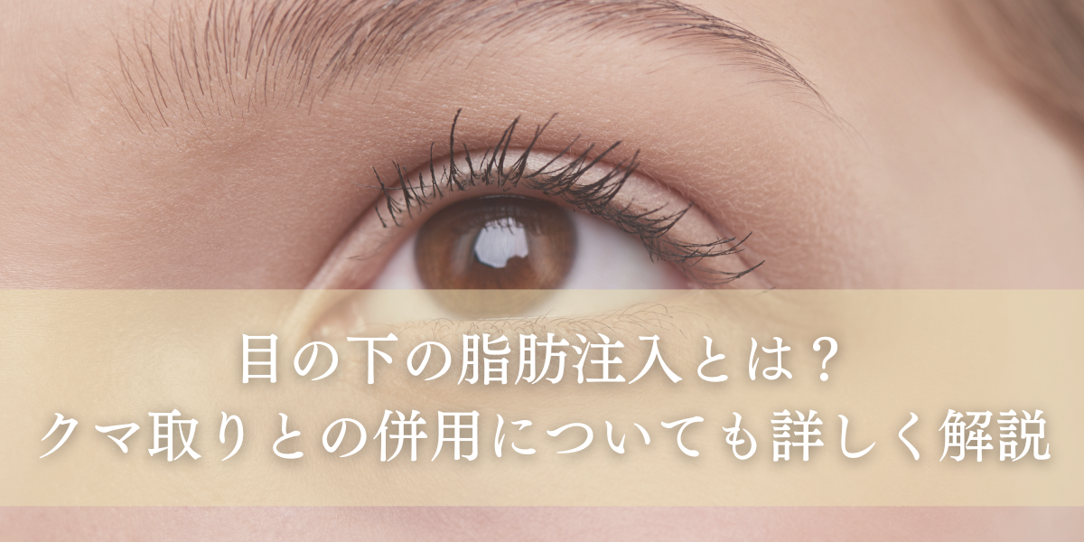 目の下の脂肪注入とは?クマ取りとの併用についても詳しく解説!