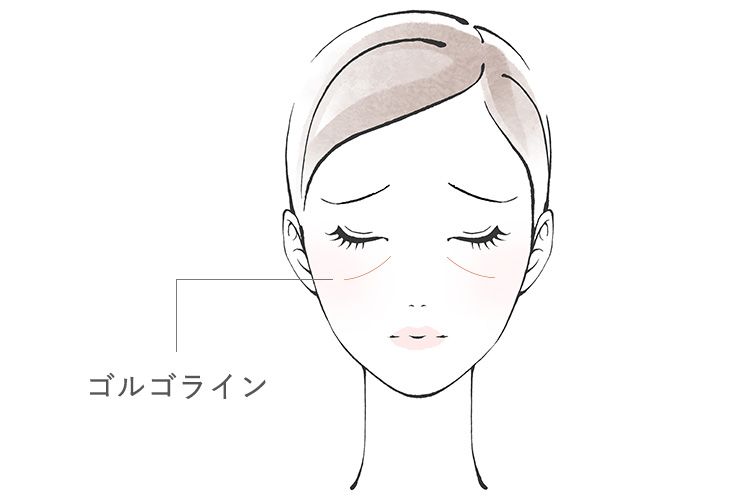 ゴルゴラインに悩む女性