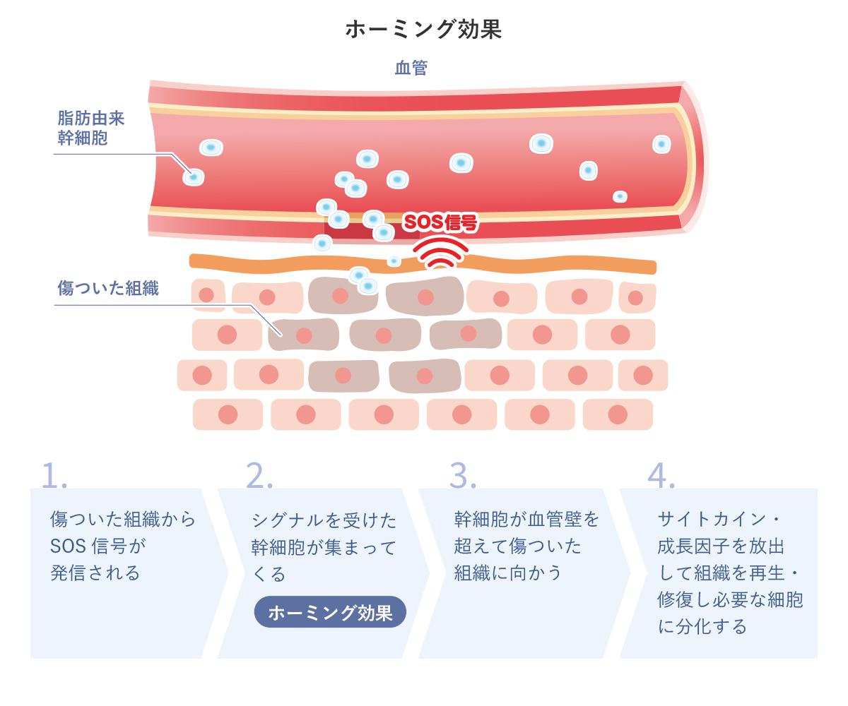 ホーミング効果