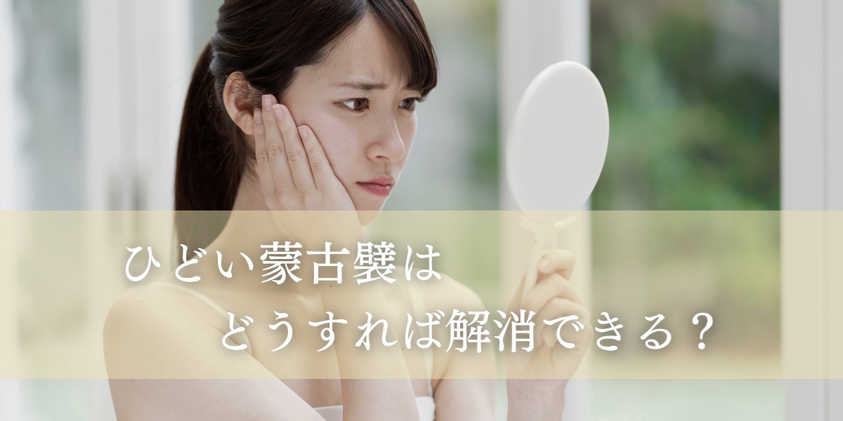 ひどい蒙古襞はどうすれば解消できる?
