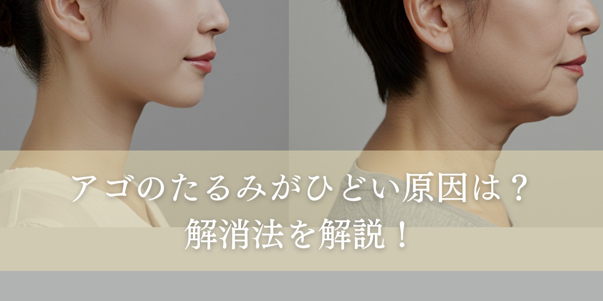 アゴのたるみがひどい原因は?解消するためのセルフケアや治療法を解説!