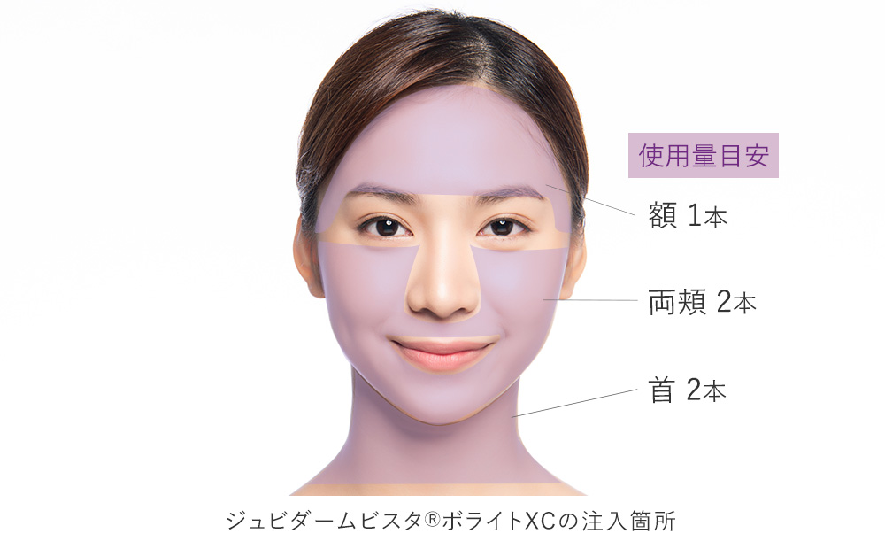 ジュビダームビスタ®ボライトXCの注入箇所