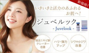 ジュベルック（Juvelook）