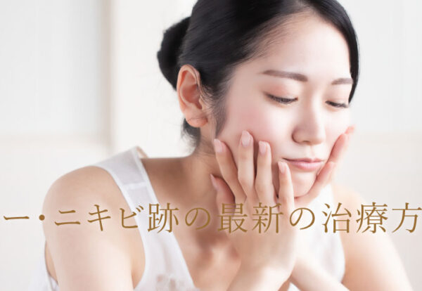 クレーター・ニキビ跡最新治療