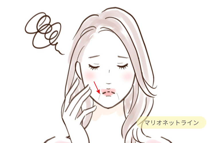 マリオネットライン