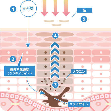 シミ治療なら大阪のPCS 通常