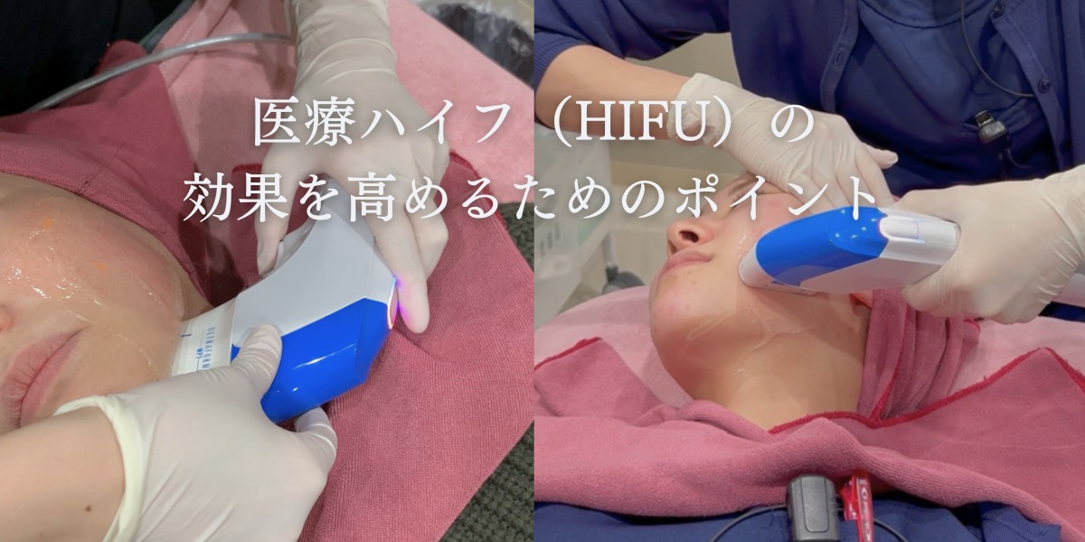 医療ハイフ(HIFU)の効果を高めるためのポイント