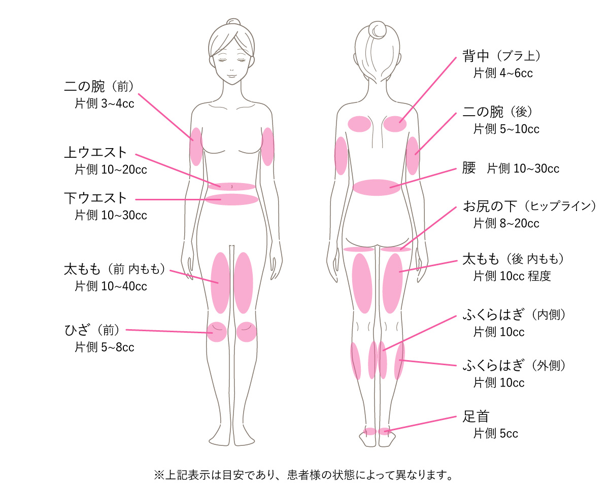 脂肪溶解注射の施術部位