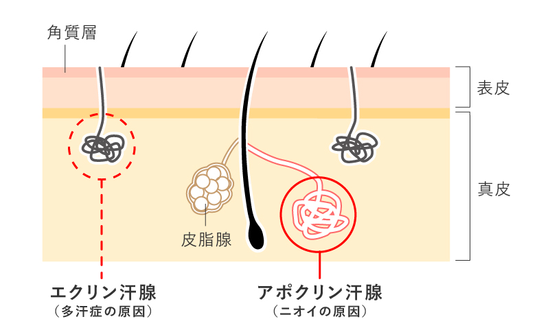 多汗症のメカニズム（エクリン線とアポクリン線）