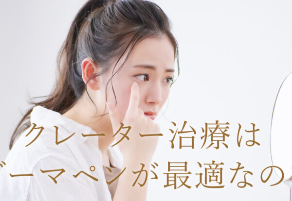 クレーター治療はダーマペンが最適？