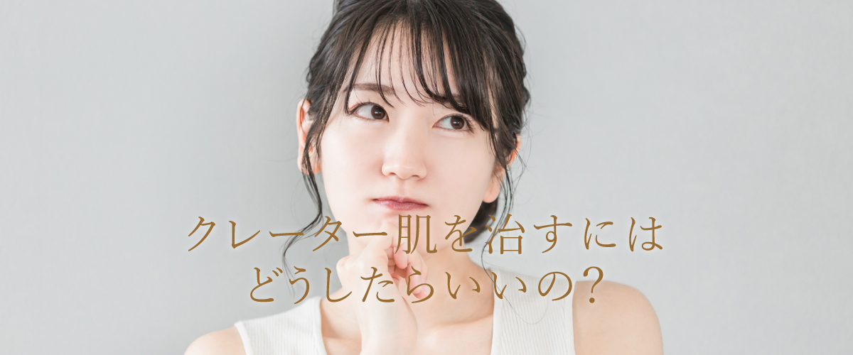 クレーター肌を治すには?適切な治療方法について解説!
