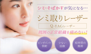 シミ取りレーザー（Q-YAGレーザー）