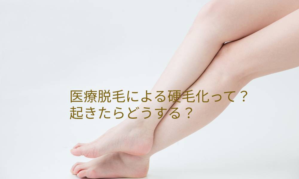 医療脱毛による硬毛化って?起きたらどうする?