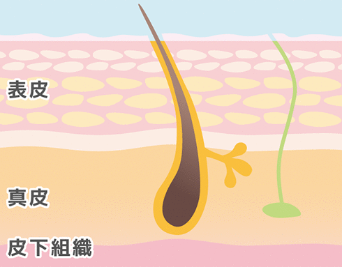 しわ・たるみの原因 表皮・真皮・皮下組織の3層構造
