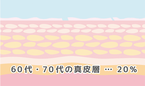 しわ・たるみの原因 60台・70代の真皮層