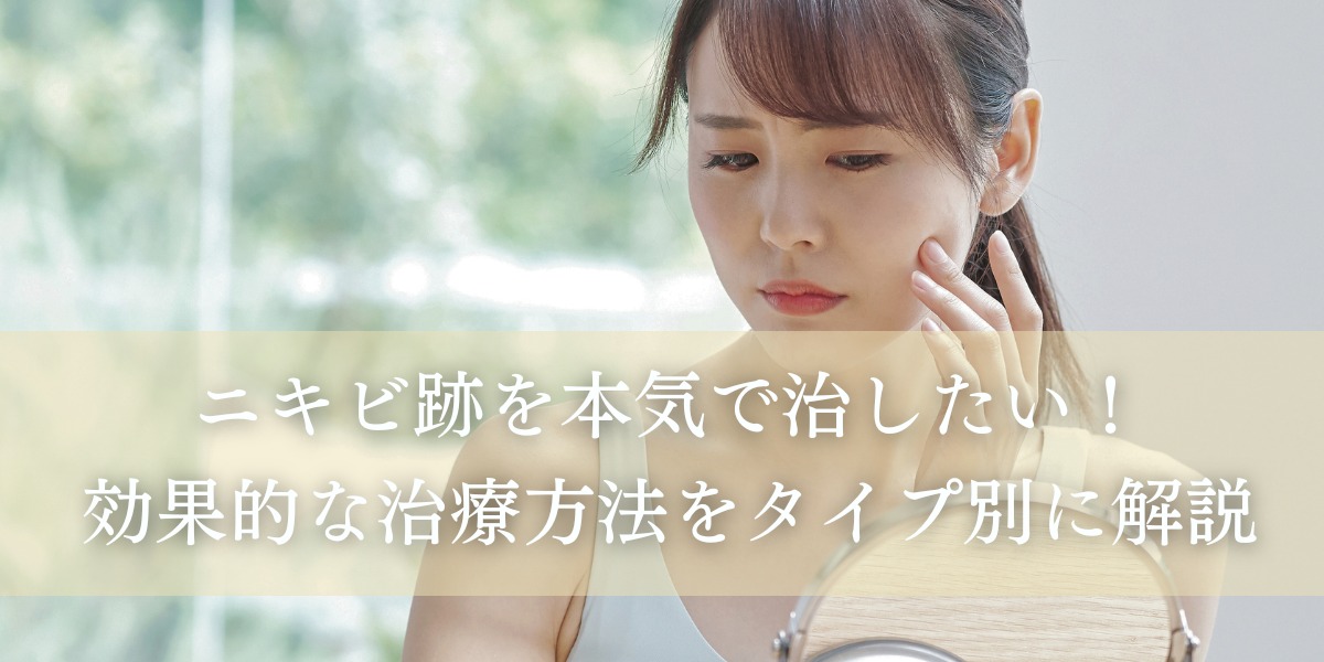 ニキビ跡を本気で治したい!効果的な治療方法をタイプ別に解説
