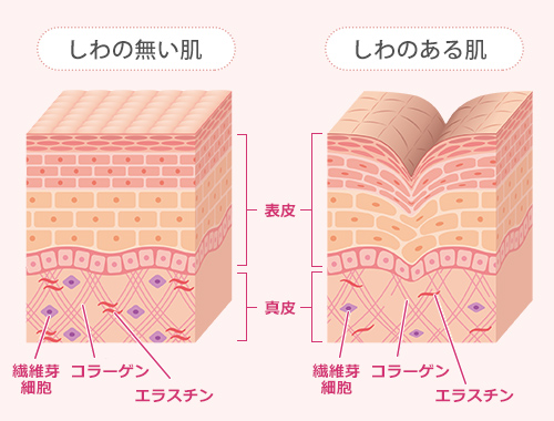 しわのない肌としわのある肌