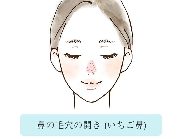 いちご鼻を予防！鼻の毛穴の開き