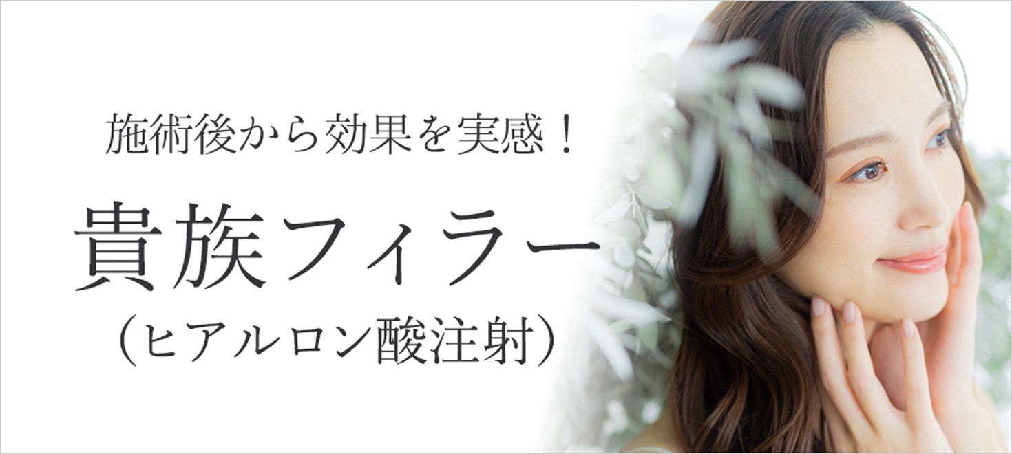 貴族フィラーでほうれい線が目立たなくなる！