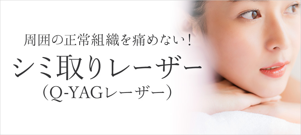 シミ・そばかす治療にはシミ取りレーザー