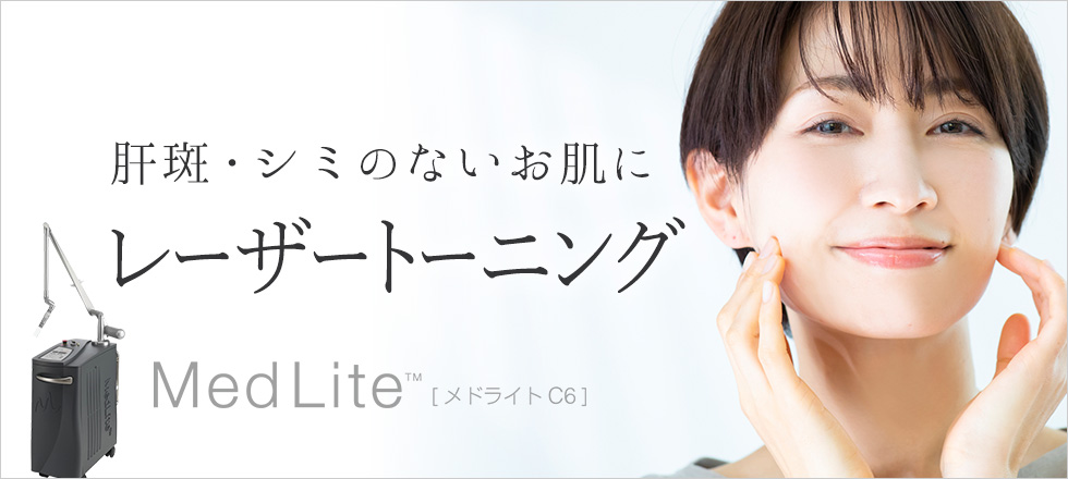 レーザートーニングで肝斑・シミのないお肌に