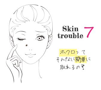 美肌治療で大阪ならPSCで肌のトラブルチェック　Skin Trouble7　ほくろってそんなに簡単に取れるの？