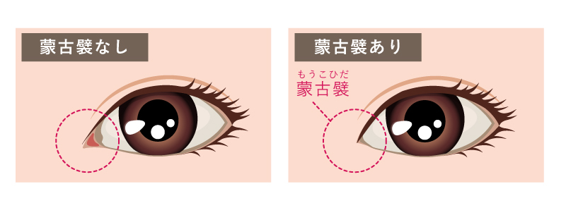 蒙古襞なしと蒙古襞ありの比較