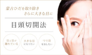 目頭切開法