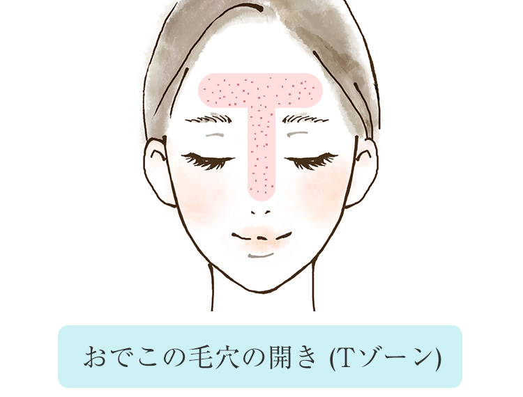 おでこの毛穴の開き。おでこは皮脂の分泌が活発！