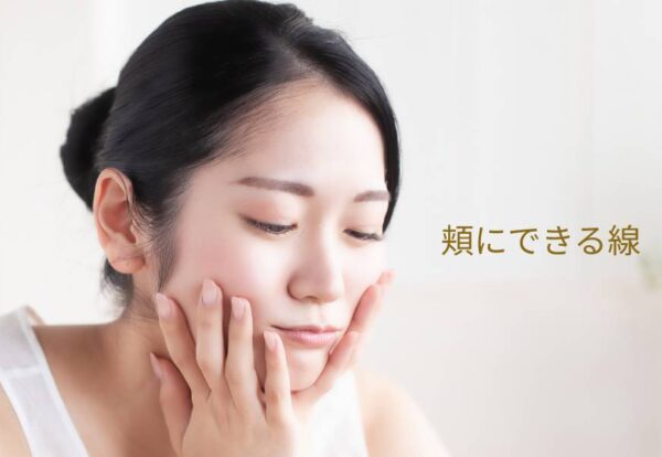 頬にできる線